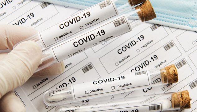 ЯК ПІДГОТУВАТИСЯ ДО ПЛР-ТЕСТУ