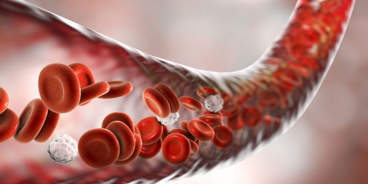 Тромбоз як ускладнення COVID-19